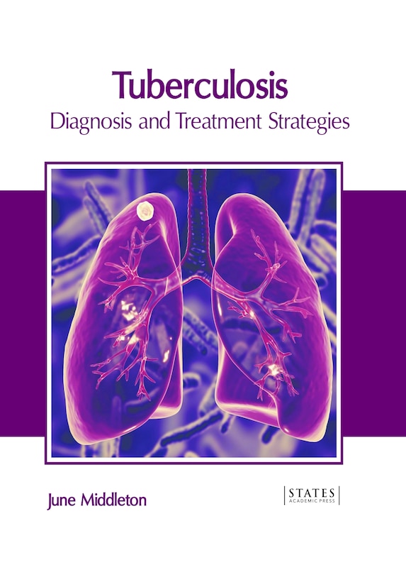 Front cover_Tuberculosis: Diagnosis and Treatment Strategies