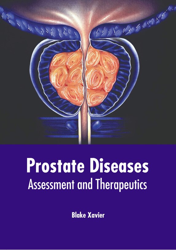 Front cover_Prostate Diseases: Assessment and Therapeutics