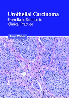 Front cover_Urothelial Carcinoma: From Basic Science to Clinical Practice