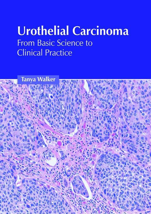 Front cover_Urothelial Carcinoma: From Basic Science to Clinical Practice