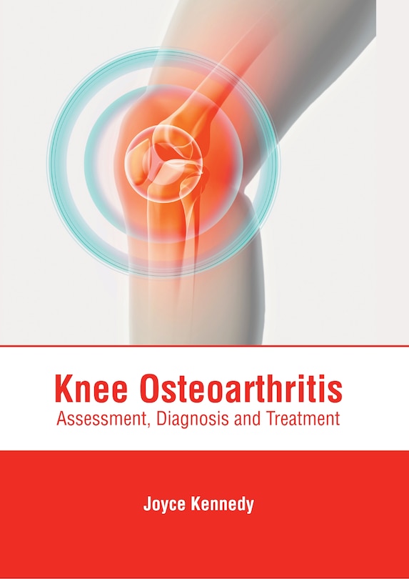 Couverture_Knee Osteoarthritis: Assessment, Diagnosis And Treatment