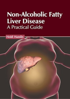 Front cover_Non-Alcoholic Fatty Liver Disease: A Practical Guide