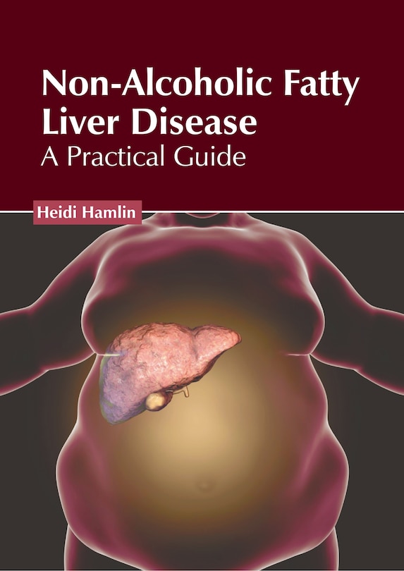 Front cover_Non-Alcoholic Fatty Liver Disease: A Practical Guide
