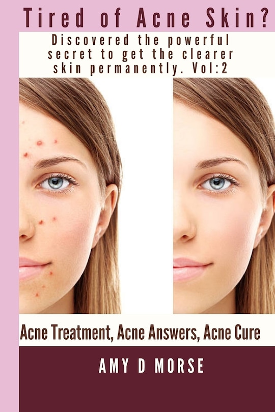 Couverture_TIRED OF ACNE SKIN? Discover the Powerful Secrets to get Clearer Skin Permanently