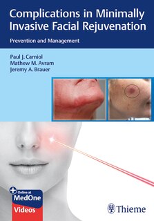 Front cover_Complications In Minimally Invasive Facial Rejuvenation