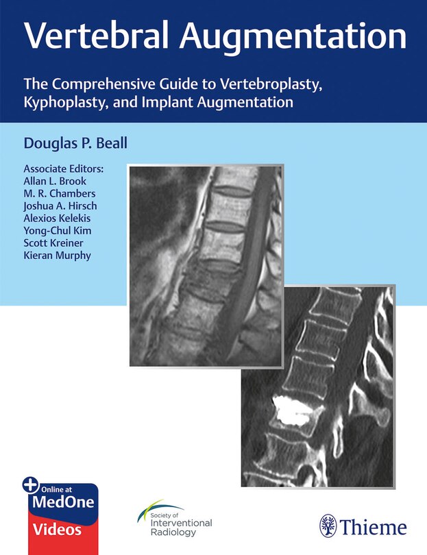 Front cover_Vertebral Augmentation