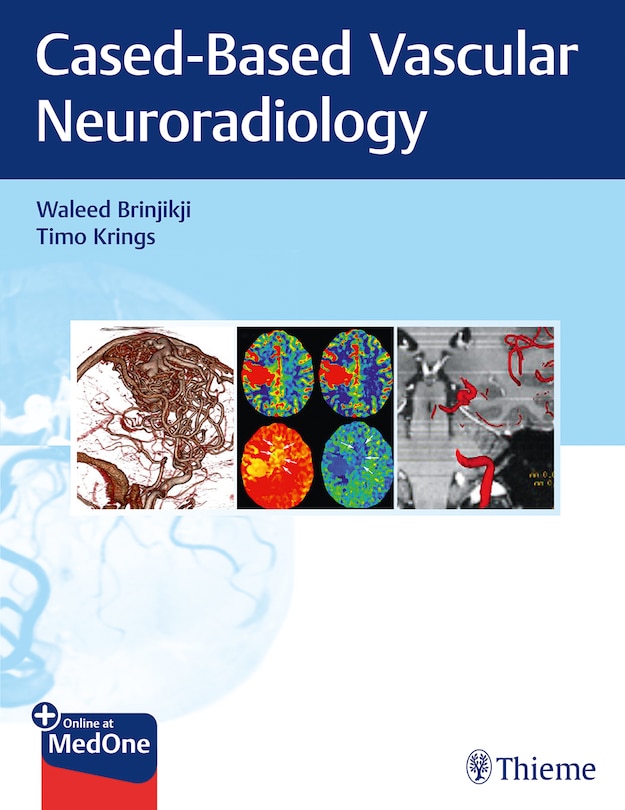 Imaging In Neurovascular Disease: A Case-based Approach