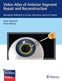 Front cover_Video Atlas Of Anterior Segment Repair And Reconstruction