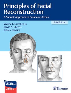 Front cover_Principles Of Facial Reconstruction