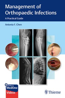 Couverture_Management of Orthopaedic Infections