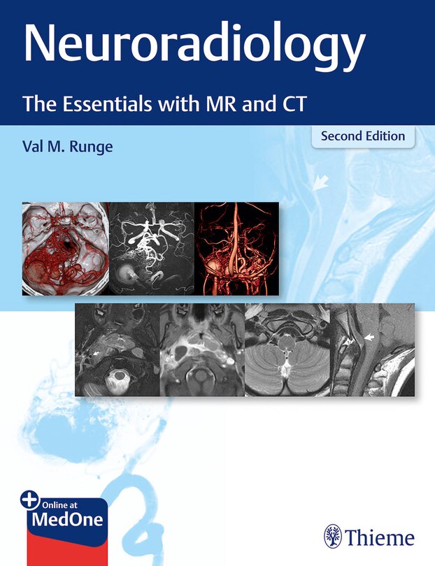Couverture_Neuroradiology