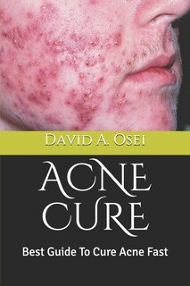 Front cover_Acne Cure