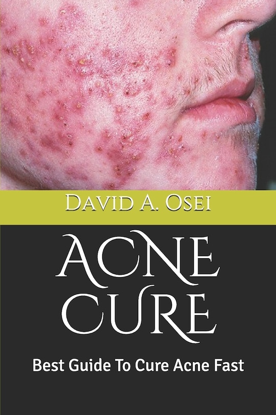 Front cover_Acne Cure