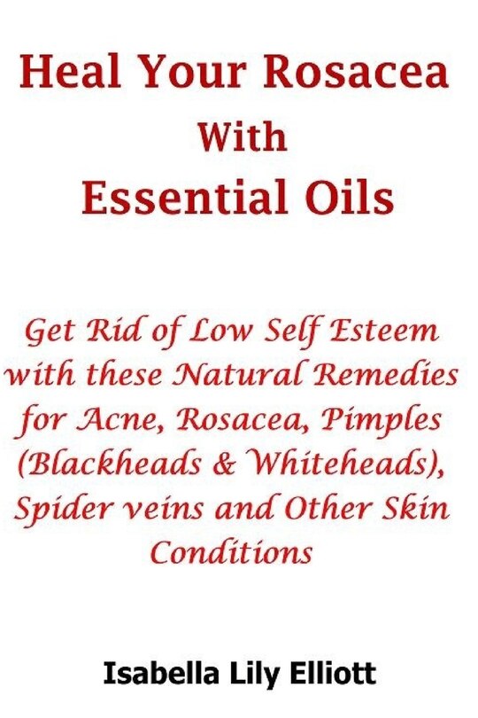 Front cover_Heal Your Rosacea with Essential Oils