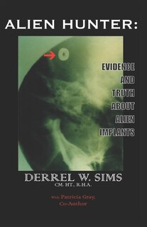 Front cover_Alien Implants