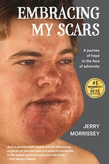 Couverture_Embracing My Scars