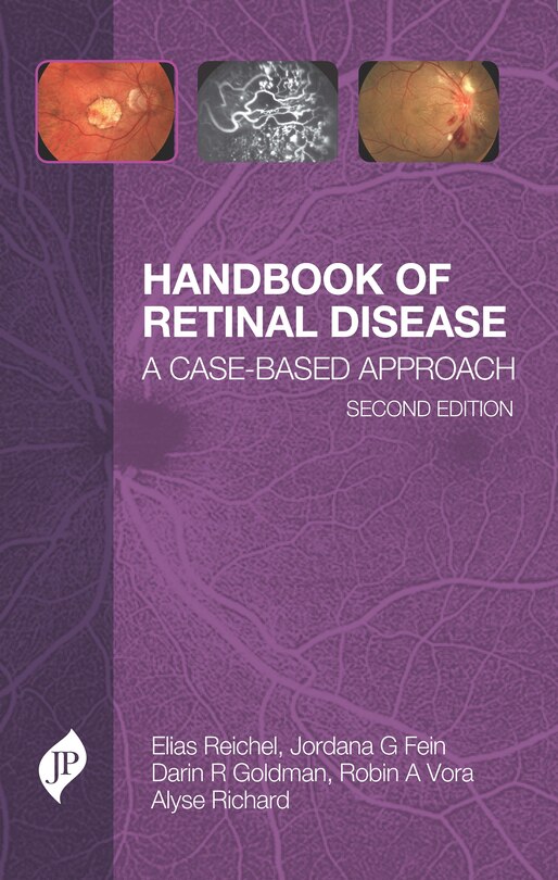 Couverture_Handbook of Retinal Disease