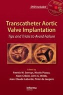 Couverture_Transcatheter Aortic Valve Implantation