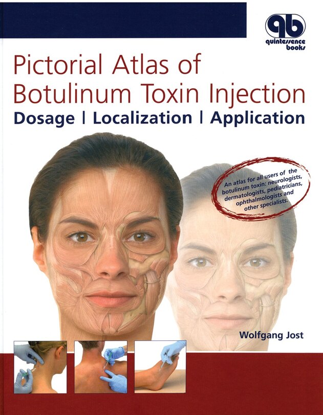 Front cover_Pictorial Atlas Of Botulinum Toxin Injection