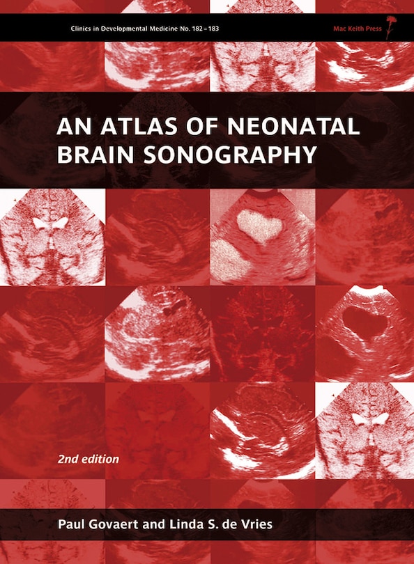 Front cover_An Atlas of Neonatal Brain Sonography