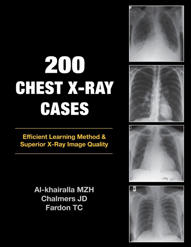 Front cover_200 Chest X-Ray Cases