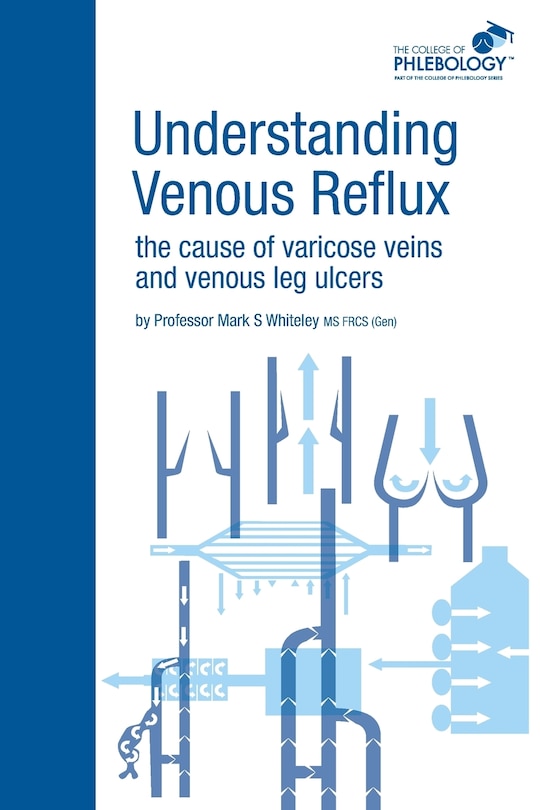 Front cover_Understanding Venous Reflux The Cause Of Varicose Veins And Venous Leg Ulcers