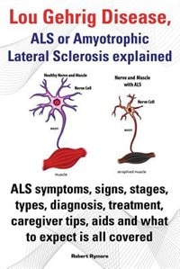 Lou Gehrig Disease, ALS or Amyotrophic Lateral Sclerosis Explained. ALS Symptoms, Signs, Stages, Types, Diagnosis, Treatment, Caregiver Tips, AIDS and