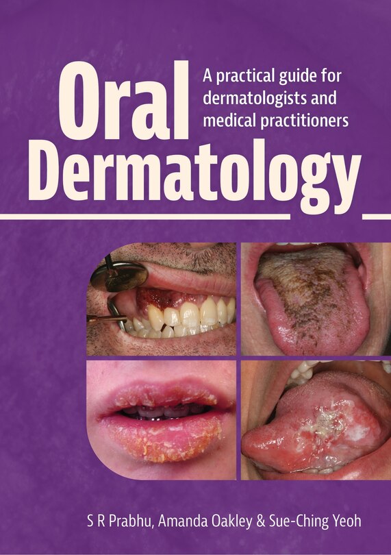 Front cover_Oral Dermatology