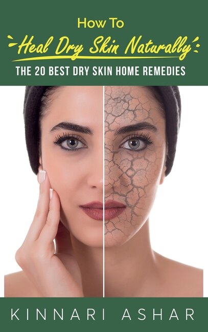 Front cover_How to Heal Dry Skin Naturally