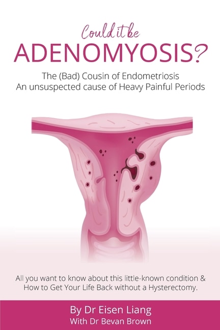 Front cover_Adenomyosis -the Bad Cousin Of Endometriosis
