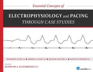 Essential Concepts Of Electrophysiology And Pacing Through Case Studies
