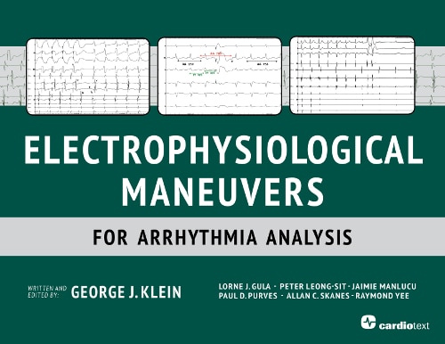 Electrophysiological Maneuvers For Arrhythmia Analysis