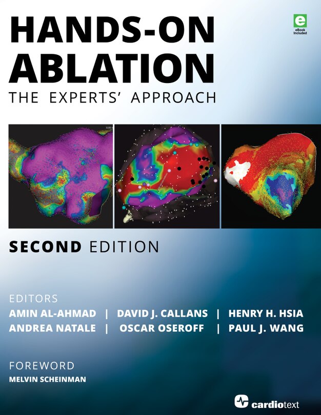 Front cover_Hands-on Ablation
