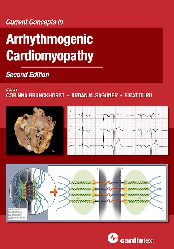 Front cover_Current Concepts in Arrhythmogenic Cardiomyopathy