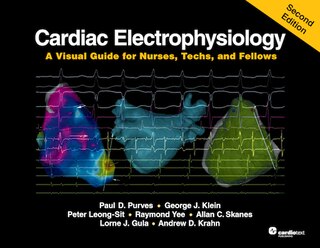 Cardiac Electrophysiology: A Visual Guide For Nurses, Techs, And Fellows