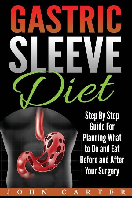 Gastric Sleeve Diet: Step By Step Guide For Planning What To Do And Eat Before And After Your Surgery