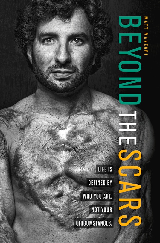 Couverture_Beyond The Scars