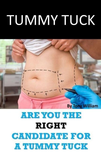 Front cover_Tummy Tuck