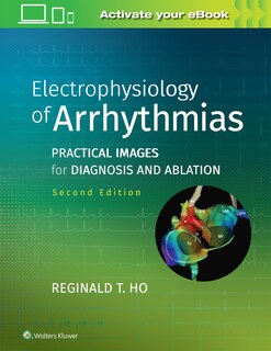 Electrophysiology Of Arrhythmias: Practical Images For Diagnosis And Ablation