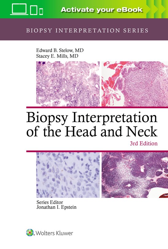 Front cover_Biopsy Interpretation Of The Head And Neck