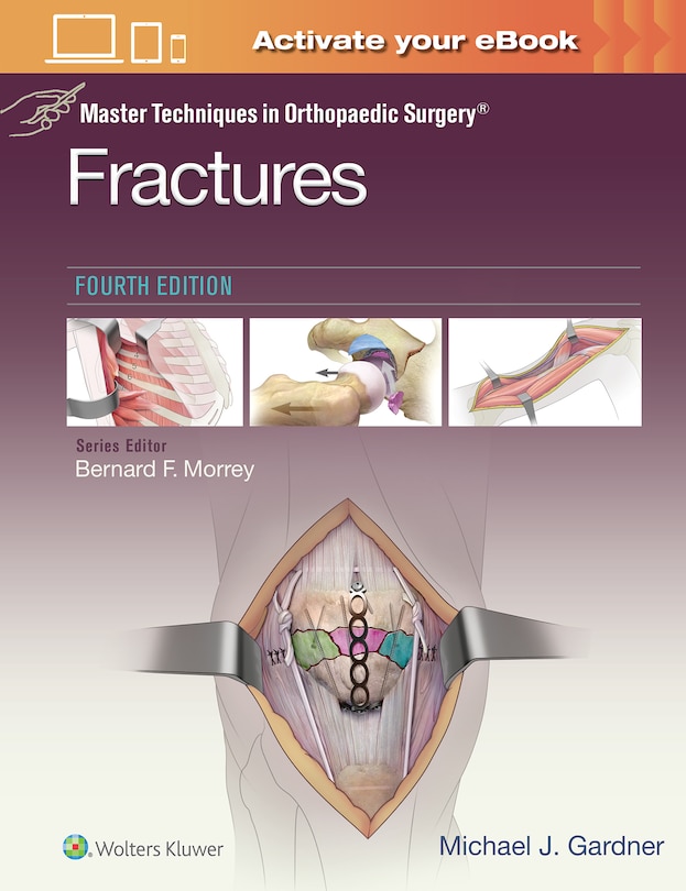 Front cover_Master Techniques In Orthopaedic Surgery