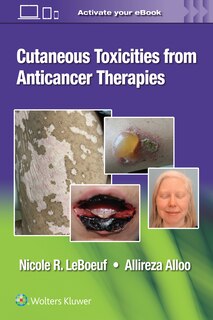 Couverture_Cutaneous Toxicities from Anticancer Therapies