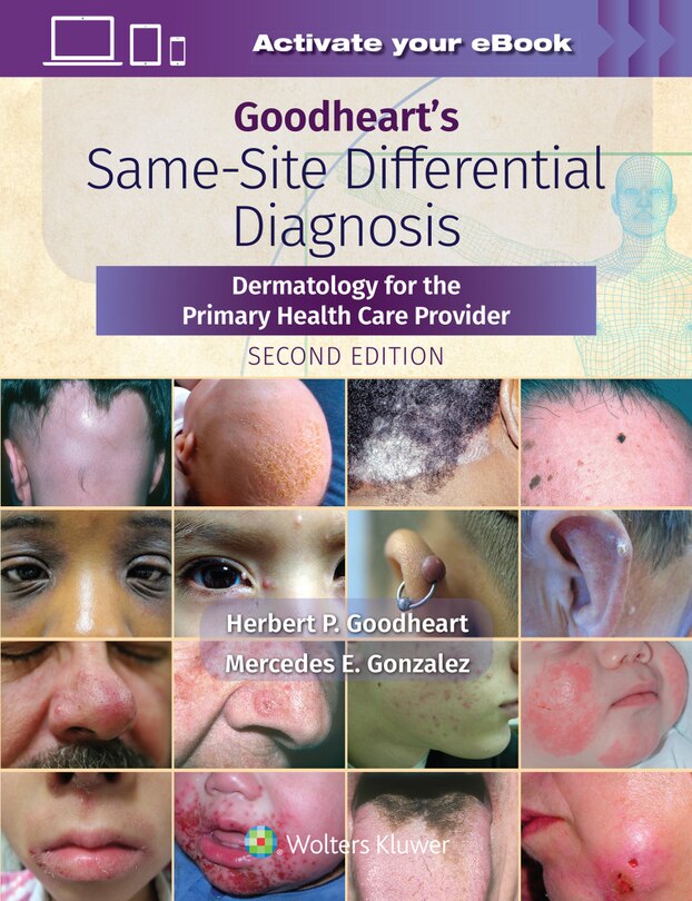 Front cover_Goodheart's Same-site Differential Diagnosis