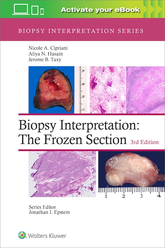 Front cover_Biopsy Interpretation