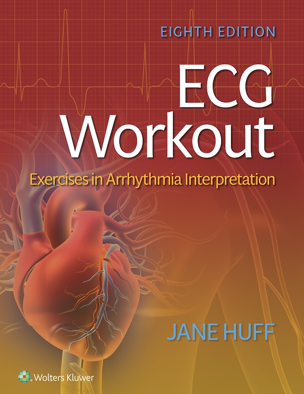 Ecg Workout: Exercises In Arrhythmia Interpretation