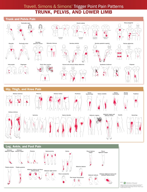 Travell, Simons And Simons' Trigger Point Pain Patterns Wall Chart: Trunk, Pelvis, And Lower Limb