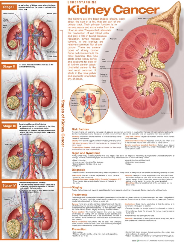 Front cover_Understanding Kidney Cancer Anatomical Chart