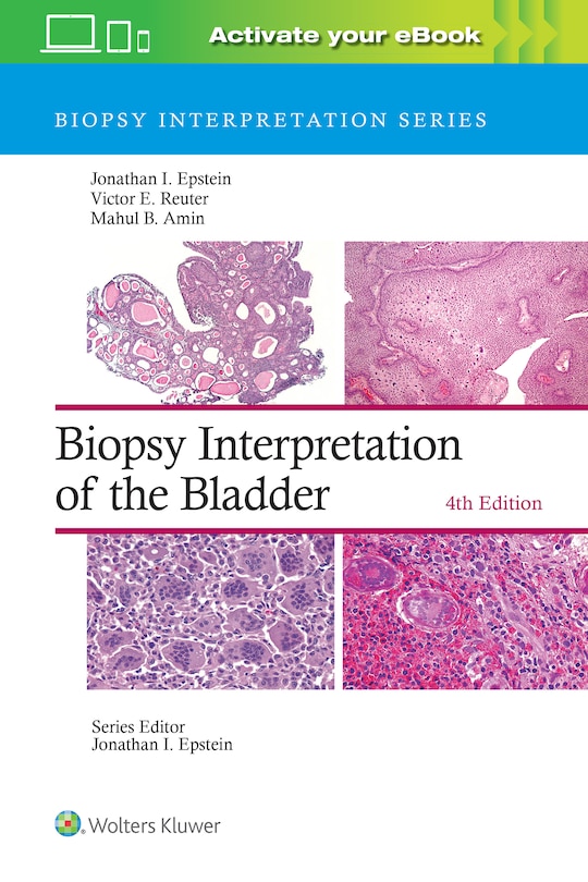 Couverture_Biopsy Interpretation of the Bladder