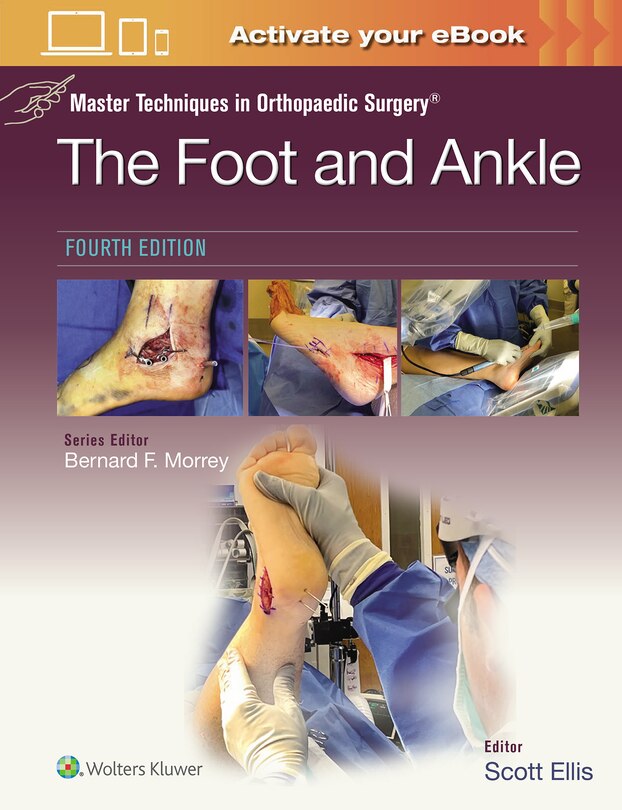 Front cover_Master Techniques in Orthopaedic Surgery