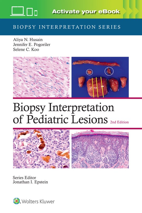 Front cover_Biopsy Interpretation of Pediatric Lesions